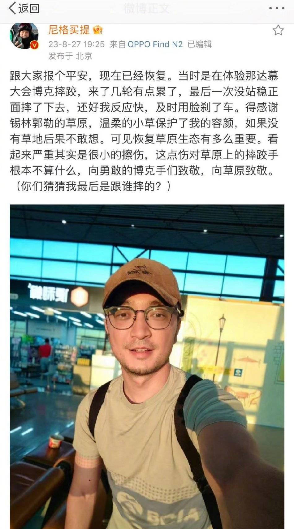 尼格买提回应节目受伤 称感谢草原保护自己的脸