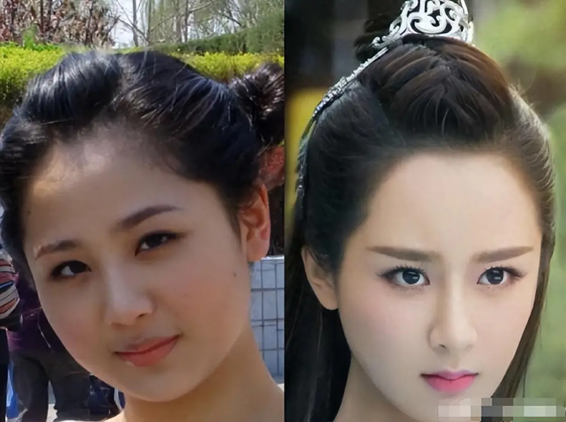 这还叫没整？杨紫僵硬笑不出，谢依霖鼻子移位，戚薇大变样