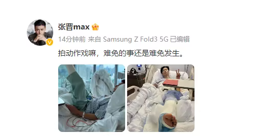 蔡少芬老公张晋拍动作戏受伤 卧床打石膏不忘对镜比耶