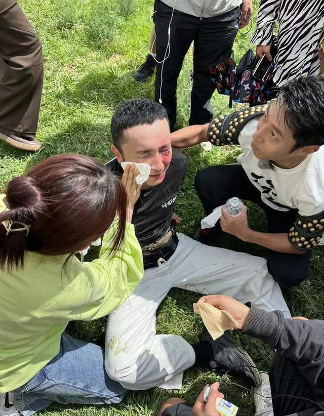 原创            尼格买提录制节目时摔伤，半张脸已经红肿，撒贝宁在一旁悉心照料