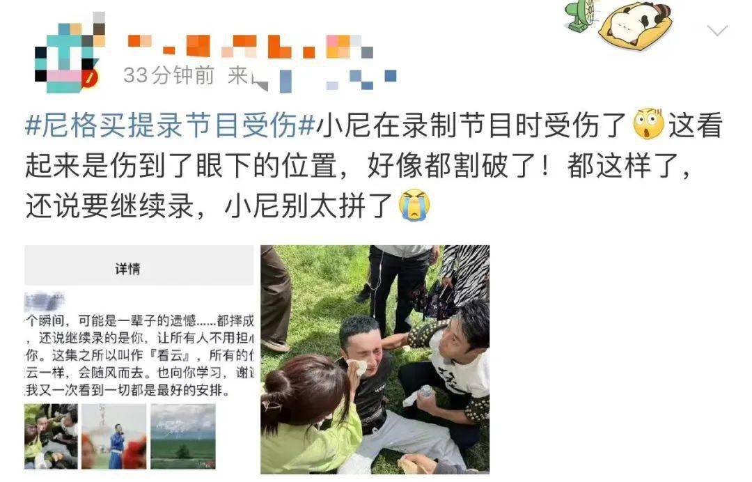 尼格买提录节目摔伤！半张脸红肿跌坐地上，撒贝宁忙搀扶一脸紧张