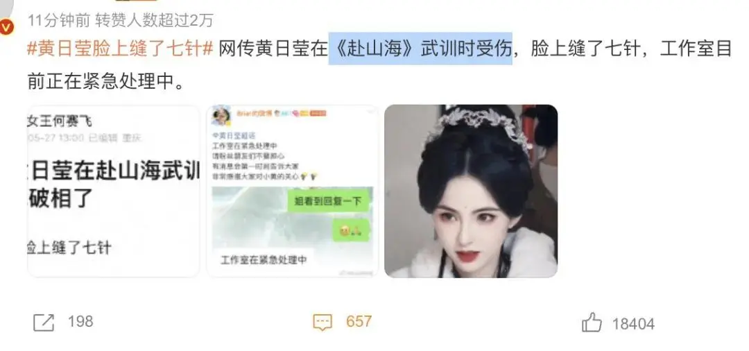长得太像李若彤了！30岁女演员武训时受伤，脸上被缝了7针
